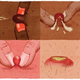 Image for article titled The Book Of Jezebel: Z Is For Zits